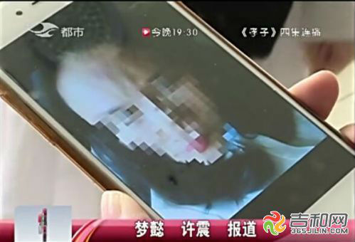 闀挎槬姝ｉ煩鍖荤枟缇庡鍖婚櫌,闀挎槬缇庡澶辫触