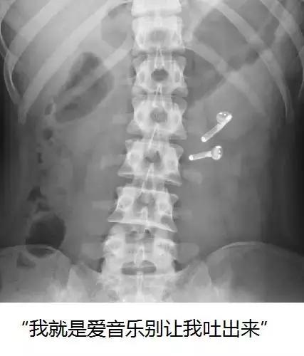 狗狗便血了？！养宠一定要知道的狗狗血便原因