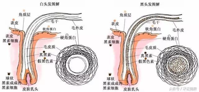 为啥会白头发,为什么你会有白头发