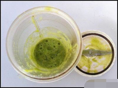 老年斑能去除吗怎么去除,咪喹莫特能祛除老年斑吗