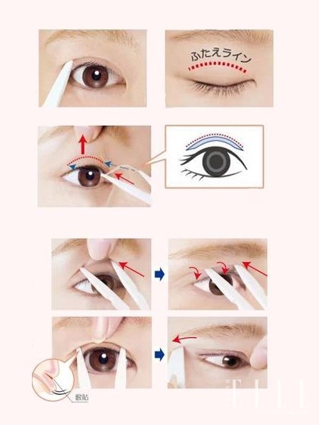 双眼皮100种整形图解,双眼皮整形全程讲解