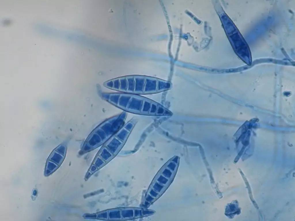 人传染了猫癣还会传染给其他人吗,得了猫癣会烂哪里