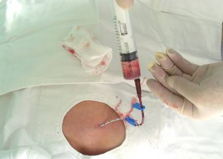 扎管的温度——北京医院肿瘤科护士手记|有故事的人