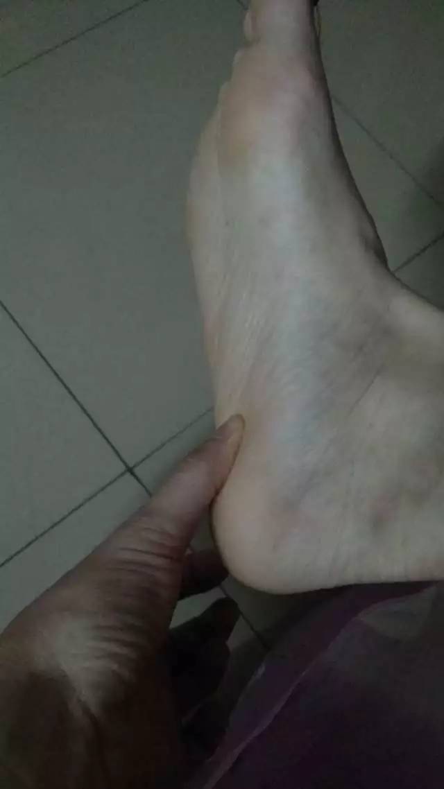 腱鞘炎需要停止打球吗,腱鞘炎问答