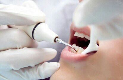 怀孕为什么不能洗牙,为什么怀孕前要检查