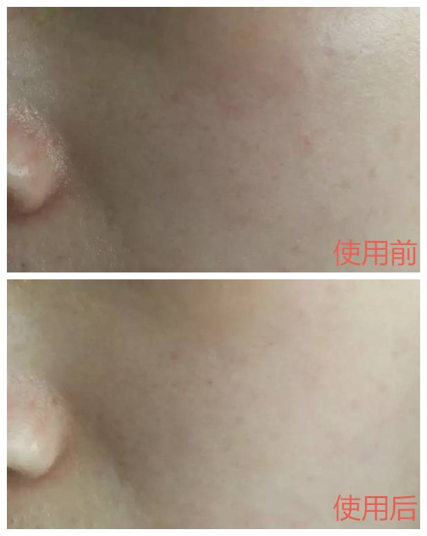 娜丽丝爽肤水缩毛孔,娜丽丝毛孔收敛水