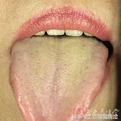 夏季吹空调感冒吃什么药效果好,夏季感冒咳嗽喉咙有痰鼻塞流鼻涕