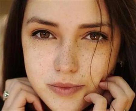 敏感肌肤能用激光吗,敏感肌肤能做激光祛斑吗