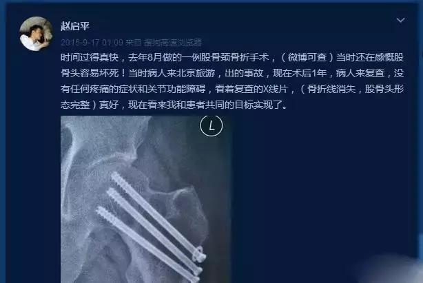 女朋友肠胃不好总是肚子疼怎么办,女朋友肠胃不舒服怎么按摩