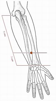 胁痛针灸,胁肋疼痛董氏针灸取穴处方