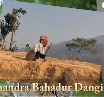 他们才是真正的超人，再大的挫折都挫不到他们，头不全又怎样