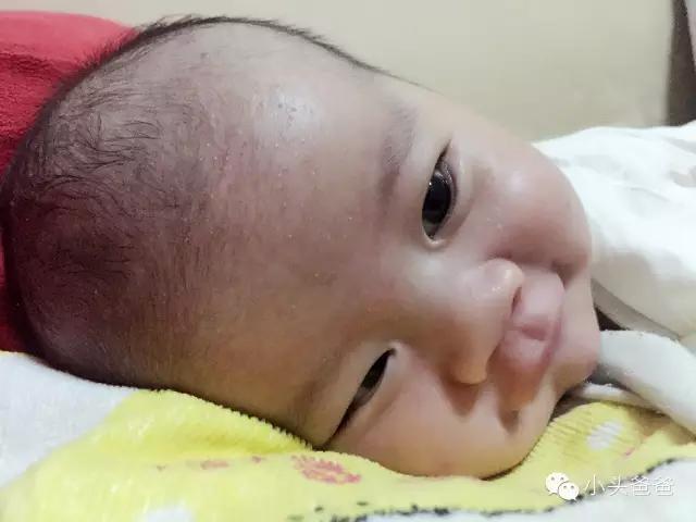 小孩脸湿疹皮肤损伤怎么修复,小婴儿皮肤湿疹