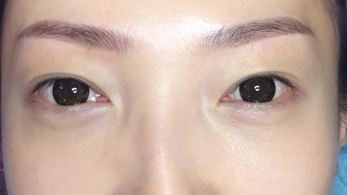 绣眉的后期效果图,绣眉后期成什么样