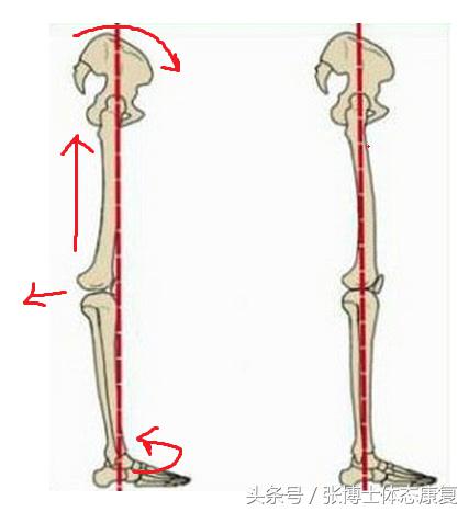 xo腿体态矫正训练动作,xo型腿怎么练康复