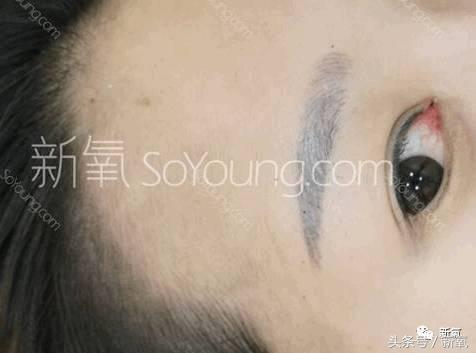 杨幂发际线还会回归吗,杨幂发际线秃到后脑勺