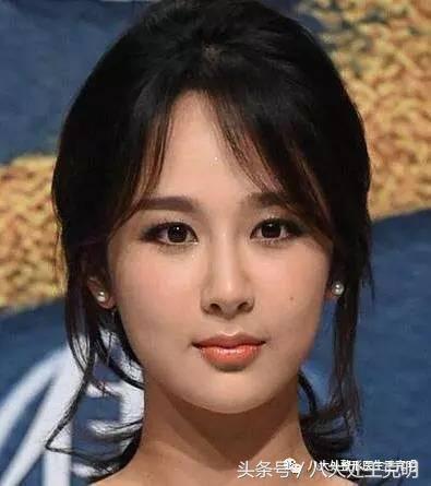 杨紫的法令纹能消除吗,杨紫法令纹很深怎么回事