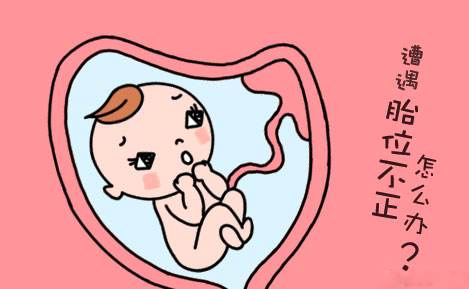 孕妈请注意最容易引起胎儿畸形,孕妈臀位