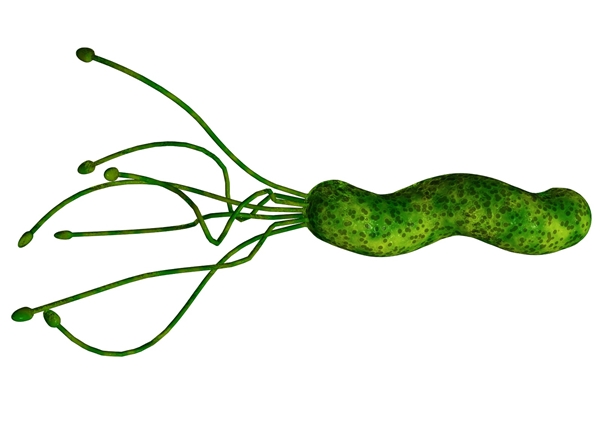 幽门螺旋杆菌到底要不要去除,幽门螺旋杆菌到底要不要紧