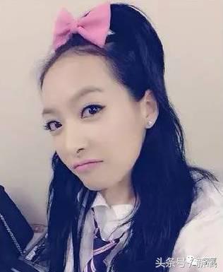 杨幂发际线还会回归吗,杨幂发际线秃到后脑勺