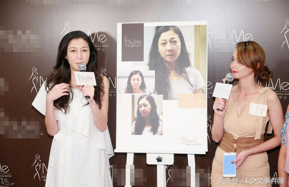 最美亚姐,韩君婷的鼻子是整容失败吗