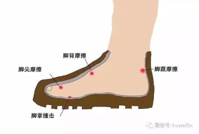 脚上长了水泡怎样才会好得快,一只脚上长水泡是什么原因引起的