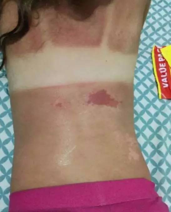 去西北旅游防晒乳推荐哪款好,进藏防晒有用吗