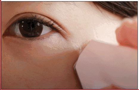 脸部凹陷法令纹用什么美容仪,stop射频美容仪祛法令纹