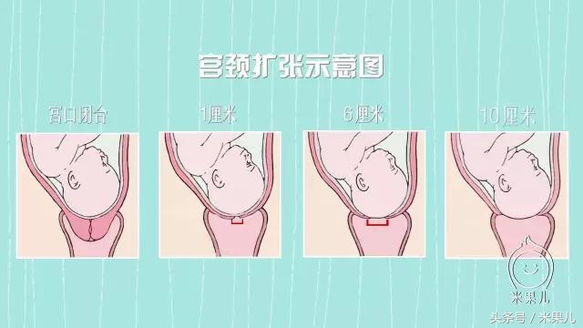 米果儿:直击分娩全过程!了解得多,担心自然就少了