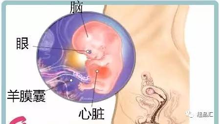 孕妇菊花上火了应该怎么办,孕期上火喝菊花水有效果吗