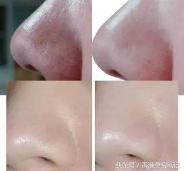 50块！毛孔就能小小小小小小小小到看不见？