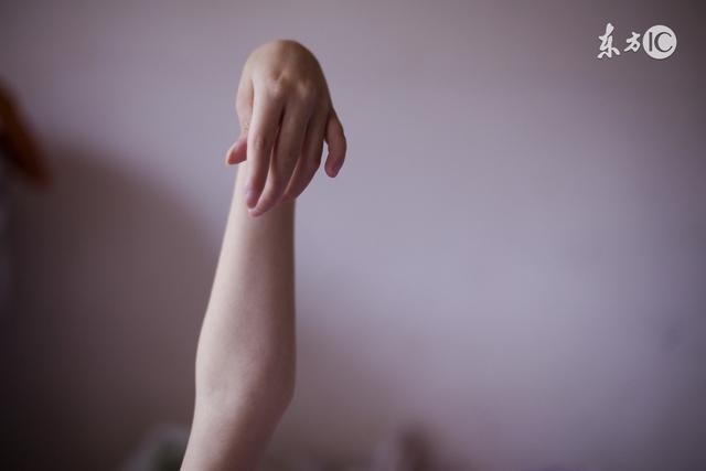 头痛型癫痫,头痛型癫痫有什么症状