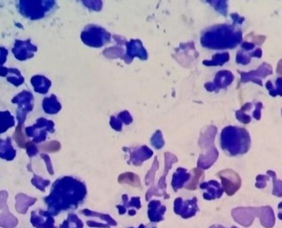 头皮上有一层厚厚的白色的头皮屑,头皮上有一层白色的头皮屑