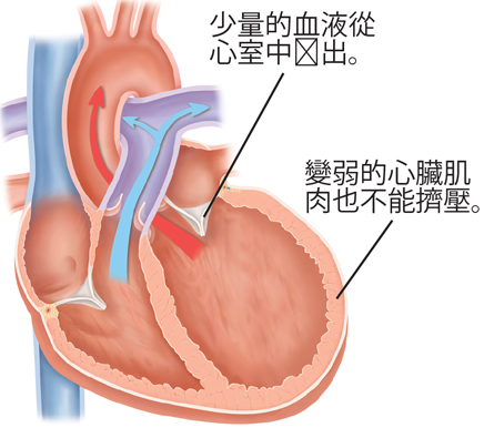 类风湿性关节炎的护理措施,类风湿性关节炎如何保护关节功能
