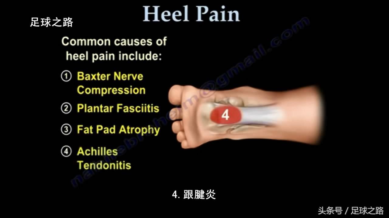 足跟痛的症状及表现,足跟痛最常见病因