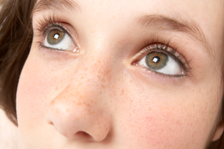 脸上大片褐斑怎么祛除,脸上有褐斑怎么去除最有效