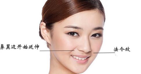 预防法令纹最有效的方法,法令纹成因及解决方法