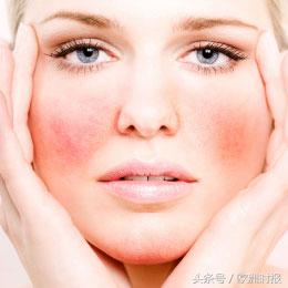 面对“阳光后遗症”，敏感肌肤该如何选择产品？