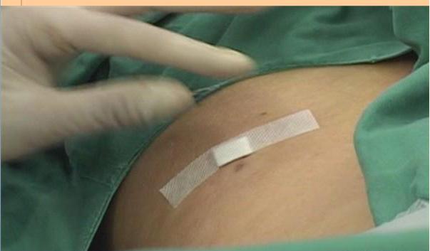 腰椎间盘突出能够完全治好吗,腰椎间盘突出能够治疗吗