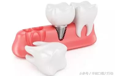 种植牙的八大优势你知道吗,种植牙的优势动画视频