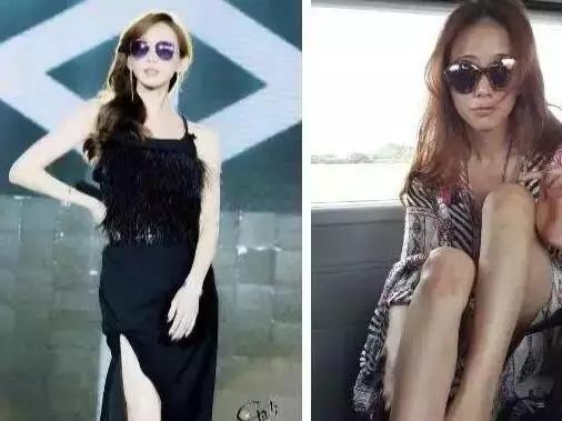 41岁林志玲打了美白针，副作用震惊了世界！