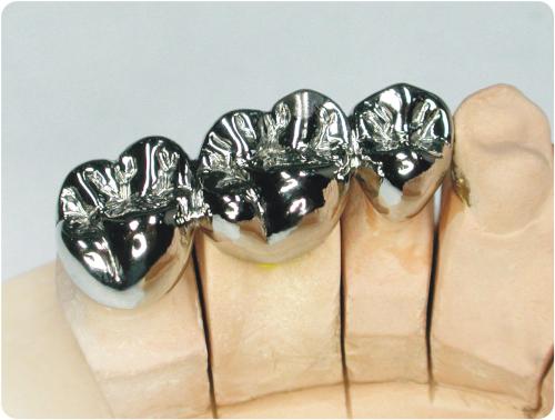 义齿知识普及,劣质义齿对身体有哪些害处