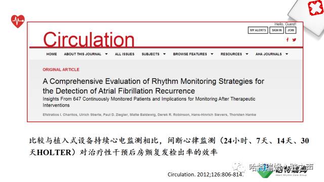 「心声」长程心电检测设备在房颤管理中的重要地位