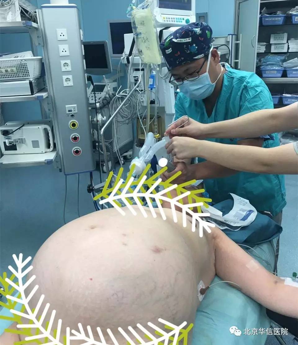 附件囊肿10厘米手术,附件囊肿切除术手术记录