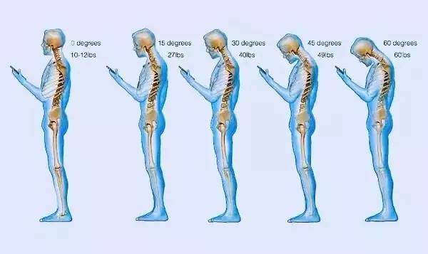 驼背矫正怎么练,驼背正确练法
