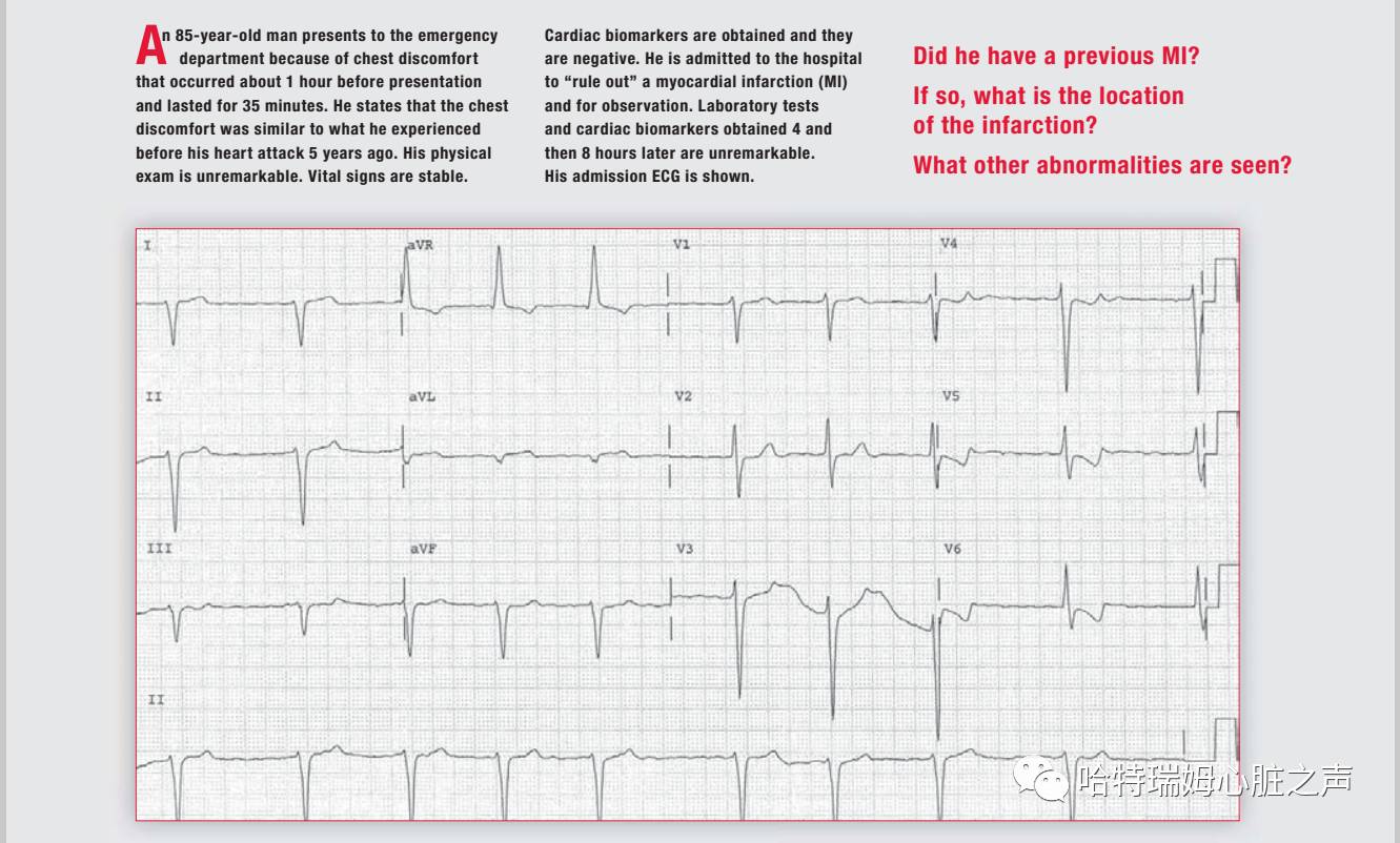 读心有术30秒,读心有术183