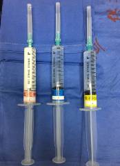 围手术期个案护理比赛优秀案例ppt,术后镇痛的规范化管理ppt