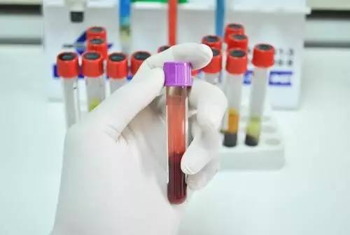 临床常用标本采集方法及注意事项,临床标本收集方法