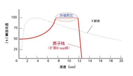 质子放疗治疗肿瘤,质子治疗肿瘤最新方法