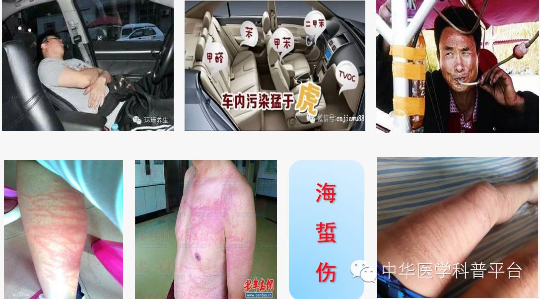 危险的中毒,危险的毒素