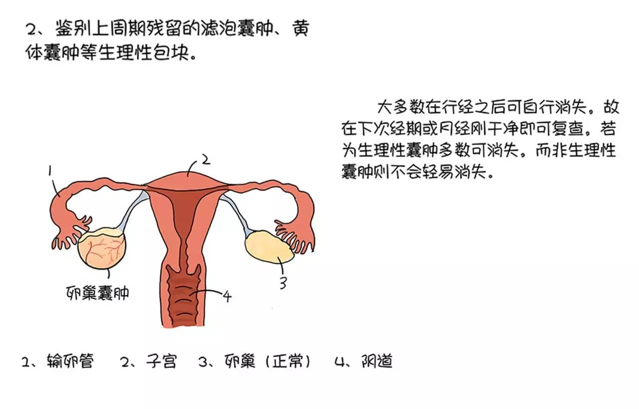 经期也可以做阴超吗,经期能做阴超吗
